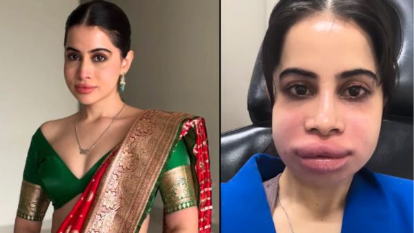 उर्फी जावेद के चेहरे का हुआ बुरा हाल, बोलीं- मेरे बॉयफ्रेंड ने मुझे…